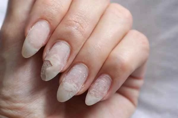 How to supplement calcium for nail deficiency