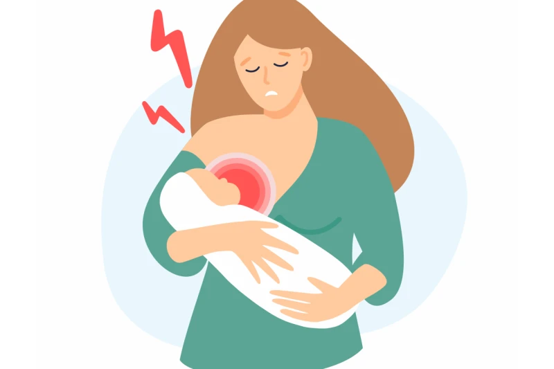 Methods to quickly relieve hives during breastfeeding