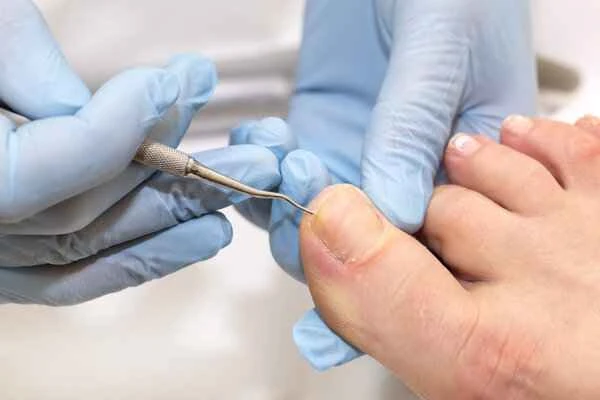 Will the gaps become larger after the inlaid armor is dug out?