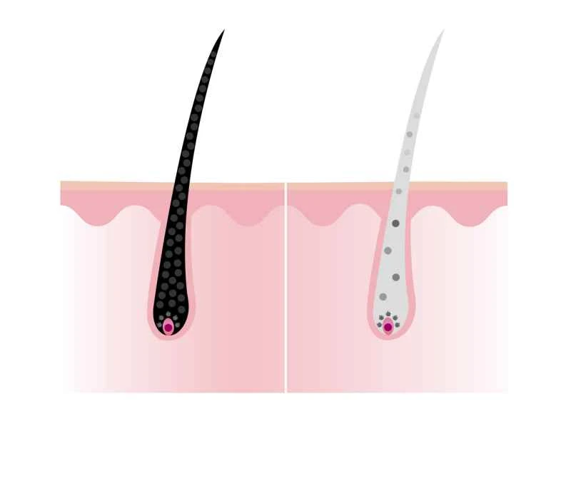 Symptoms of scalp psoriasis