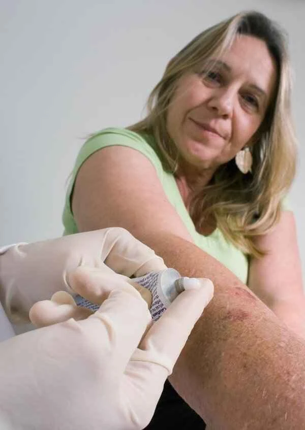 Why does my keloid scar itch after injection?