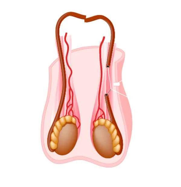 Itchy bumps on the hair follicles of the scrotum