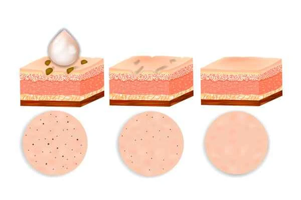 Can people with vitiligo take vitamin B?