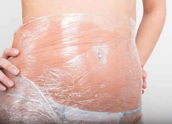 What to do about keloid scarring after a C-section?