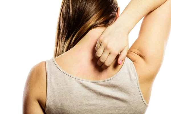 How to relieve the itching of keloid scars