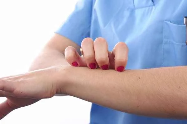 Why would someone suddenly develop dermatitis urticaria?