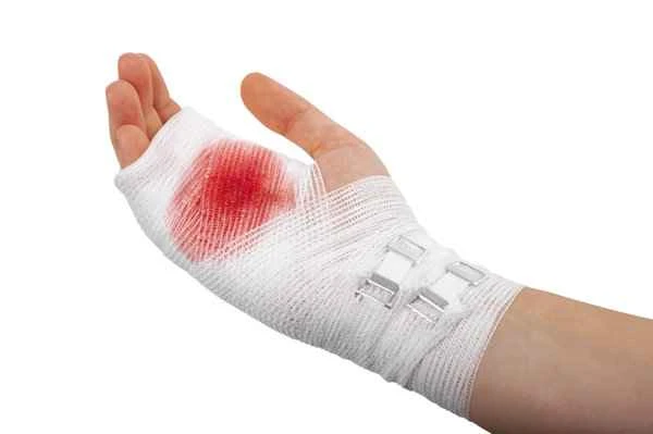 What to do about scarring on the nose