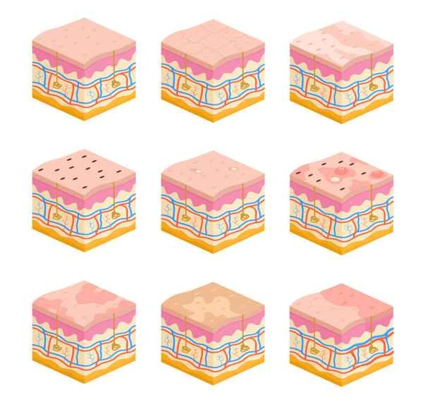 How to repair epidermal scars