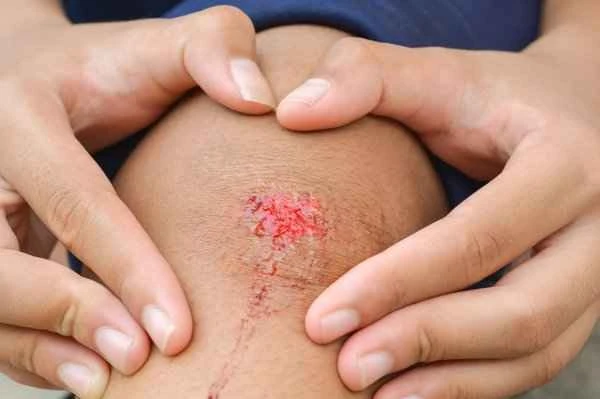 What to do about scars left by abrasions?
