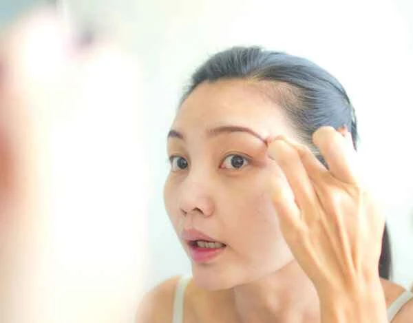 How to remove eyebrow scars?