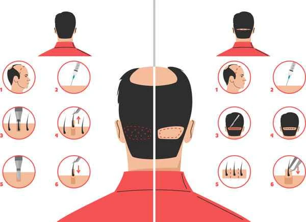 What is the best treatment for hair loss?