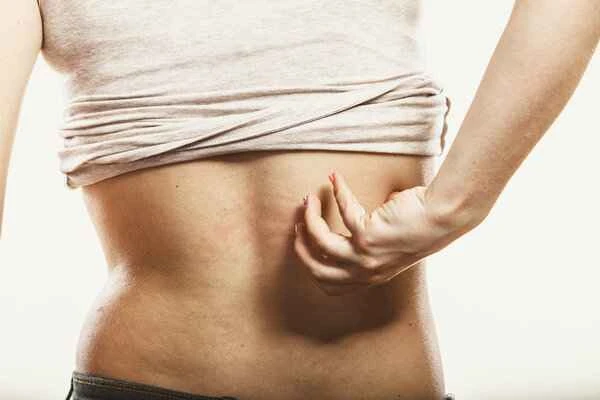 How long does it take for hives to heal on its own?