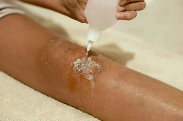 What to do about skin adhesions and pitted scars?