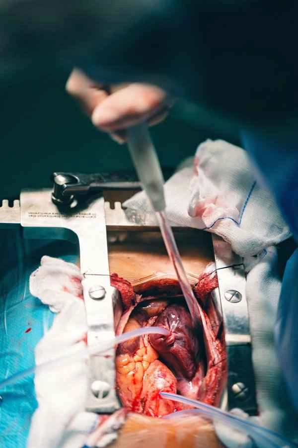 Can hypertrophic scars from surgical incisions heal?