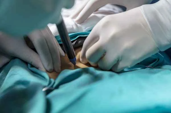 How to treat patchy scar adhesions?