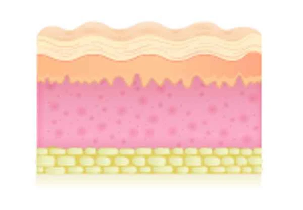 What to do if the skin barrier is damaged and inflamed