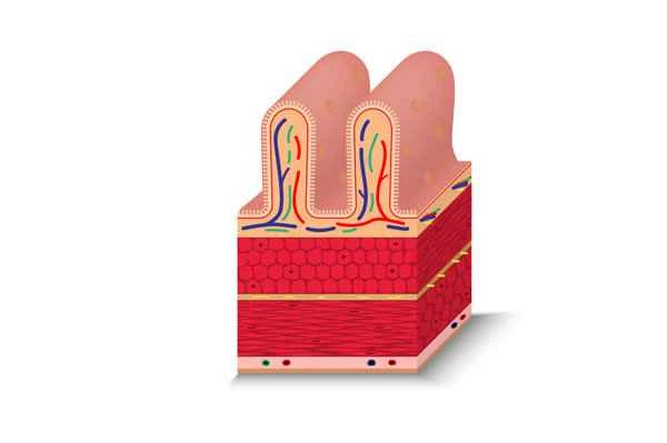 How to remove redness from hypertrophic scars