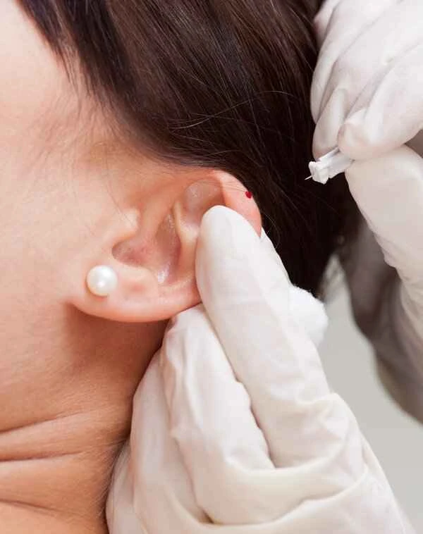 How to treat scars behind the ear