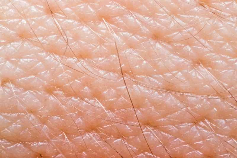 What causes urticaria?