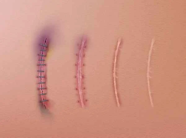 What to do about green scars on the waist?