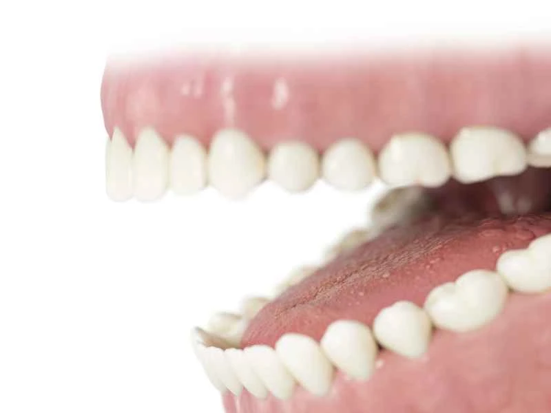 What foods should be avoided if you have urticaria?