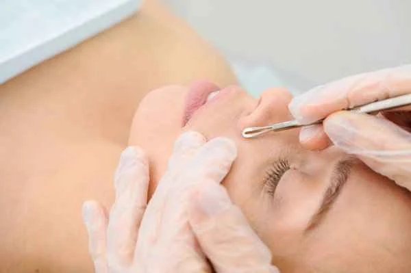 How to remove moles from the face