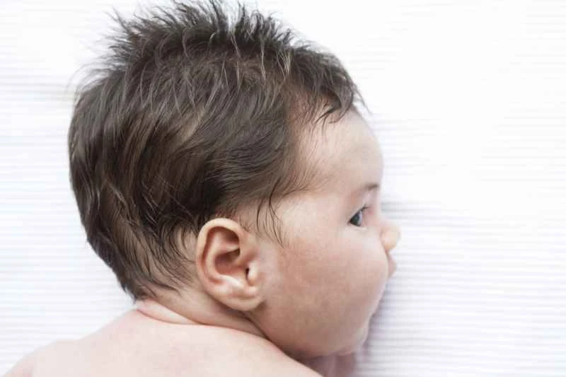 Methods to quickly reduce urticaria in children