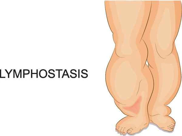 What's the fastest way to relieve pain in people with keloid scarring?