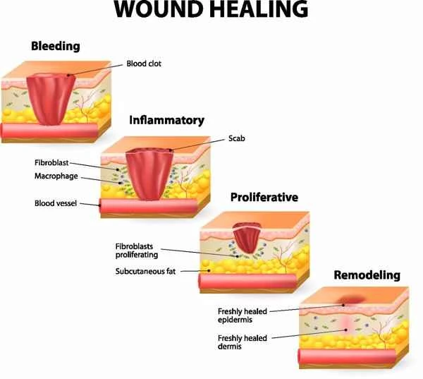 Can scars be repaired?