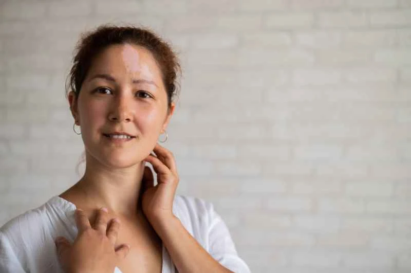 What causes eczema on the face?