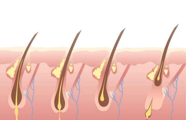 How to reduce body hair growth