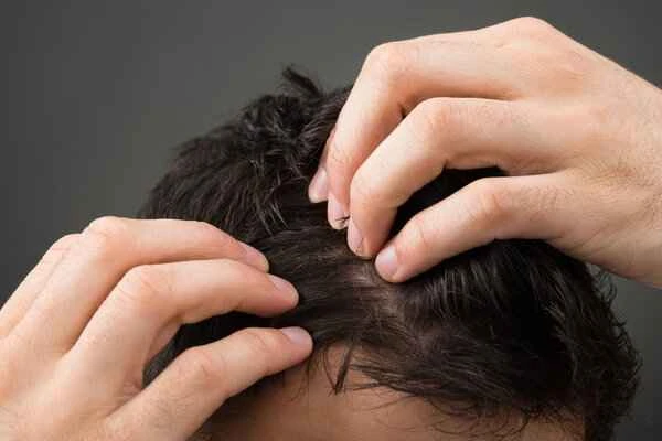 Can hair transplant medication be used for hair loss at the temples?