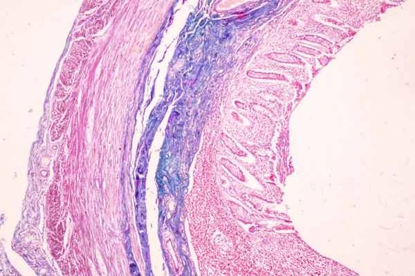 How to perform scar pathology?