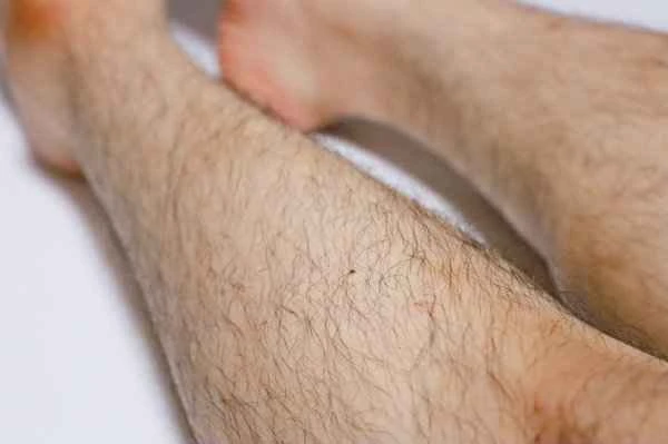 What kind of person has hair on their scrotum?