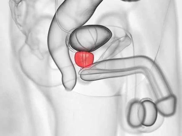 What to do about frequent folliculitis of the scrotum