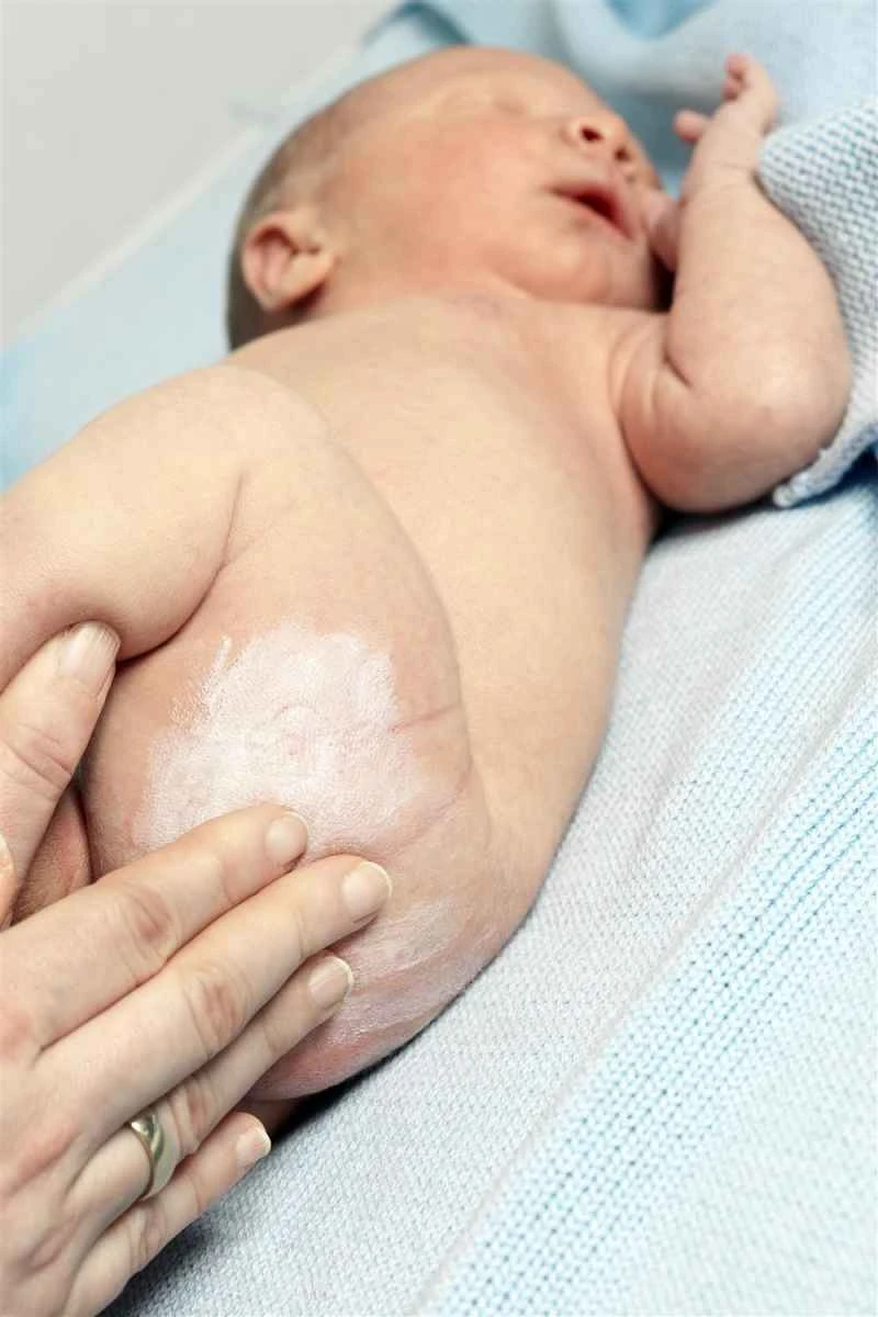 What ointment is most effective for relieving itching in children with eczema?