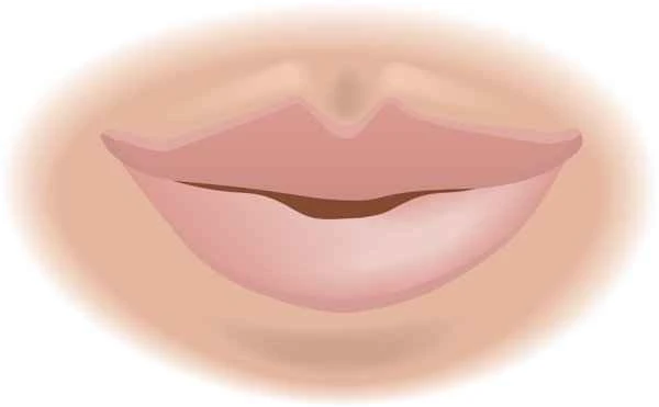What causes lips to constantly peel and crack?
