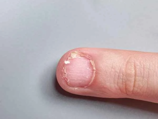 Will the gaps become larger after the inlaid armor is dug out?