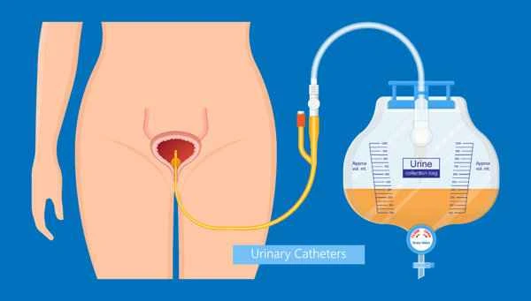 How to treat fluid accumulation in scar tissue?
