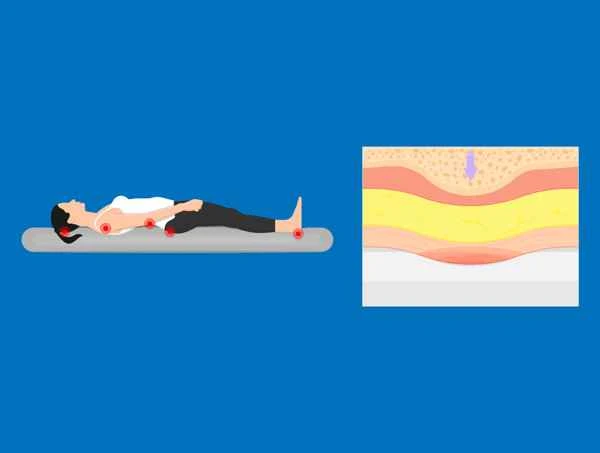 How to describe pressure ulcer scars?