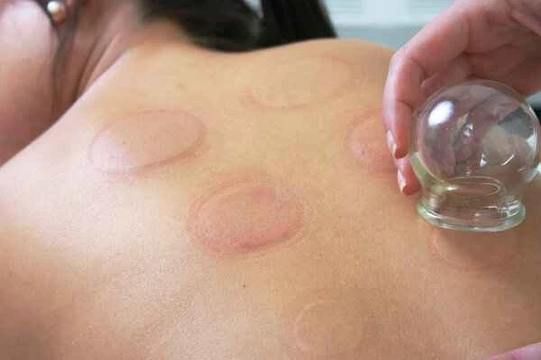 How to treat chronic urticaria caused by blood heat?