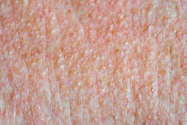 How to supplement skin with metabolic enzymes