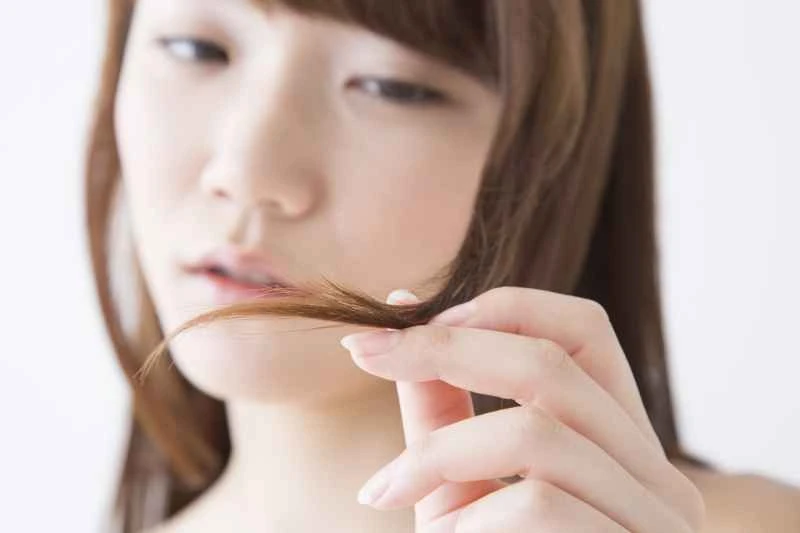 What are the symptoms of scalp psoriasis?