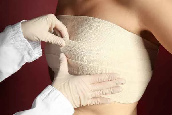 How to remove scars after surgery