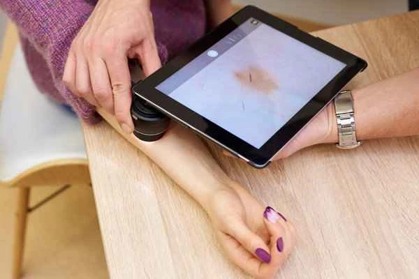 How to test for keloid scarring with tattoos